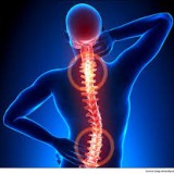 $90,000 damages for chronic neck and back pain.